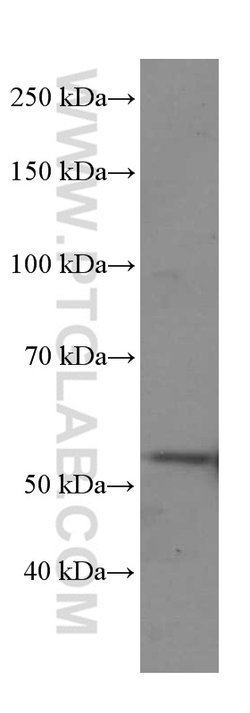 Cyclin A2 Mouse anti-Human, Clone: 1C6C11, Proteintech:Antibodies:Primary