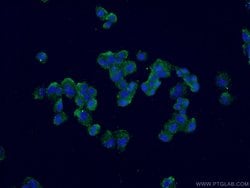Calbindin-D28k Mouse anti-Human, Mouse, Rat, Clone: 1F8B9, Proteintech