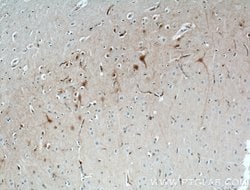 Calbindin-D28k Mouse anti-Human, Mouse, Rat, Clone: 1F8B9, Proteintech