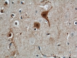 Calbindin-D28k Mouse anti-Human, Mouse, Rat, Clone: 1F8B9, Proteintech