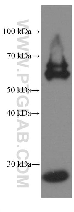 Calbindin-D28k Mouse anti-Human, Mouse, Rat, Clone: 1F8B9, Proteintech