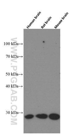 Calbindin-D28k Mouse anti-Human, Mouse, Rat, Clone: 1F8B9, Proteintech