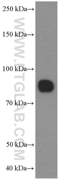 CD36 Mouse anti-Human, Clone: 1A8C5, Proteintech:Antibodies:Primary Antibodies