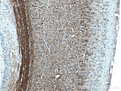 NF-M Mouse anti-Human, Mouse, Rat, Clone: 2E3B12, Proteintech:Anticuerpos:Anticuerpos