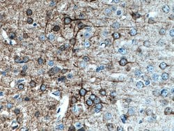 NF-M Mouse anti-Human, Mouse, Rat, Clone: 2E3B12, Proteintech:Anticuerpos:Anticuerpos