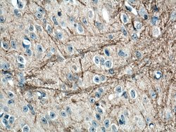 NF-M Mouse anti-Human, Mouse, Rat, Clone: 2E3B12, Proteintech:Anticuerpos:Anticuerpos