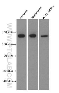 NF-M Mouse anti-Human, Mouse, Rat, Clone: 2E3B12, Proteintech:Anticuerpos:Anticuerpos