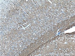 NF-M Mouse anti-Human, Mouse, Rat, Clone: 2E3B12, Proteintech