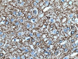 NF-M Mouse anti-Human, Mouse, Rat, Clone: 2E3B12, Proteintech:Anticuerpos:Anticuerpos