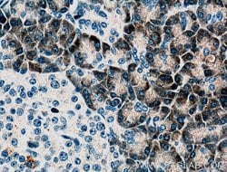 PLA2G1B Mouse anti-Human, Porcine, Clone: 1F2C10, Proteintech 150 &mu;L;