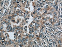 CALCOCO2 Mouse anti-Human, Mouse, Rat, Clone: 2F2C2, Proteintech:Antibodies:Primary