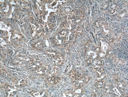 CALCOCO2 Mouse anti-Human, Mouse, Rat, Clone: 2F2C2, Proteintech:Antibodies:Primary