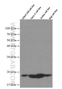 TPRKB Mouse anti-Human, Clone: 2D5B9, Proteintech 150 &mu;L; Unconjugated:Antibodies,