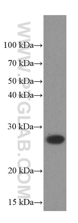 PSMB10 Mouse anti-Human, Porcine, Clone: 1G8C1, Proteintech:Antibodies:Primary