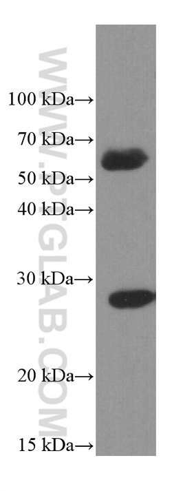 PSMB10 Mouse anti-Human, Porcine, Clone: 1G8C1, Proteintech:Antibodies:Primary