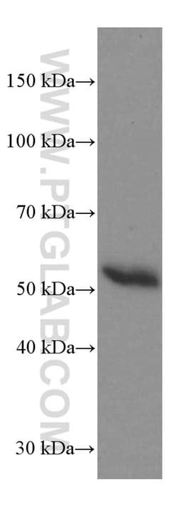 Heavy chain of IgG4 Mouse anti-Human, Clone: 1A1A2, Proteintech:Antibodies:Primary