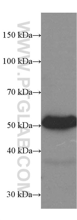 Heavy chain of IgG4 Mouse anti-Human, Clone: 1A1A2, Proteintech:Antibodies:Primary
