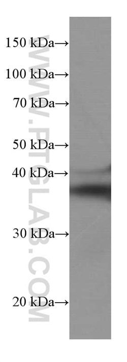SIRT2 Mouse anti-Human, Mouse, Porcine, Rat, Clone: 1D8G10, Proteintech