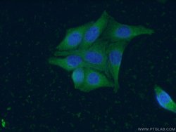 ZC3HAV1 Mouse anti-Human, Clone: 1G10B9, Proteintech 150 μL; Unconjugated:Antibodies,