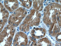 ZC3HAV1 Mouse anti-Human, Clone: 1G10B9, Proteintech 150 μL; Unconjugated:Antibodies,