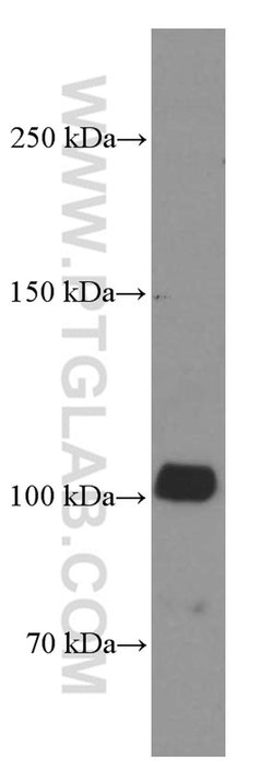 ZC3HAV1 Mouse anti-Human, Clone: 1G10B9, Proteintech 150 μL; Unconjugated:Antibodies,