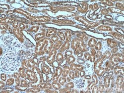 ZC3HAV1 Mouse anti-Human, Clone: 1G10B9, Proteintech 150 μL; Unconjugated:Antibodies,