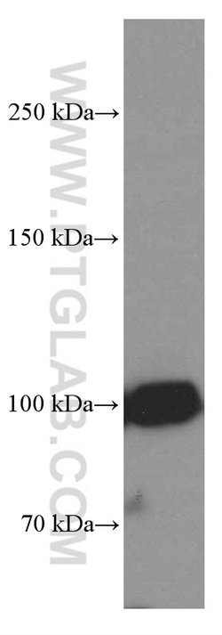ZC3HAV1 Mouse anti-Human, Clone: 1G10B9, Proteintech 150 μL; Unconjugated:Antibodies,