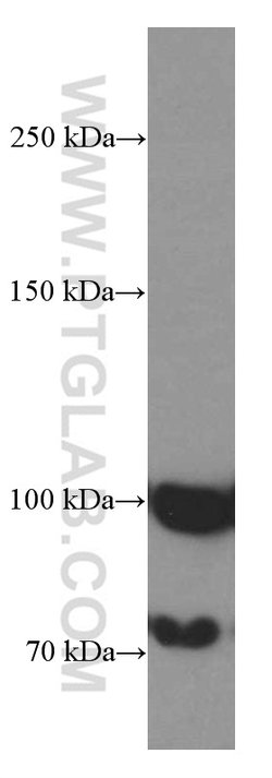 ZC3HAV1 Mouse anti-Human, Clone: 1G10B9, Proteintech 150 μL; Unconjugated:Antibodies,