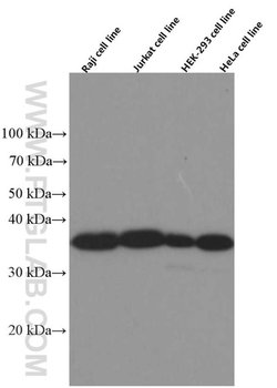 IkB alpha Mouse anti-Human, Mouse, Rat, Clone: 2G6H7, Proteintech:Antibodies:Primary