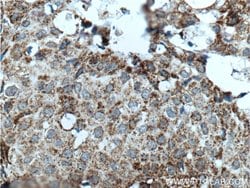 Prohibitin 2 Mouse anti-Human, Mouse, Rat, Clone: 1D9C7, Proteintech:Antibodies:Primary