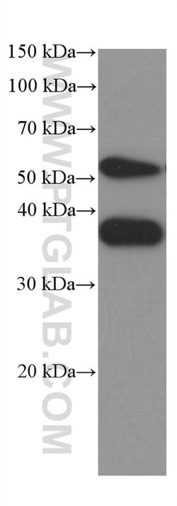 SPARC Mouse anti-Human, Clone: 1A2C1, Proteintech:Antibodies:Primary Antibodies