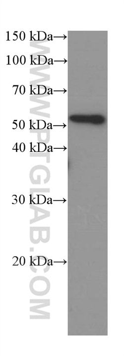 SPARC Mouse anti-Human, Clone: 1A2C1, Proteintech:Antibodies:Primary Antibodies