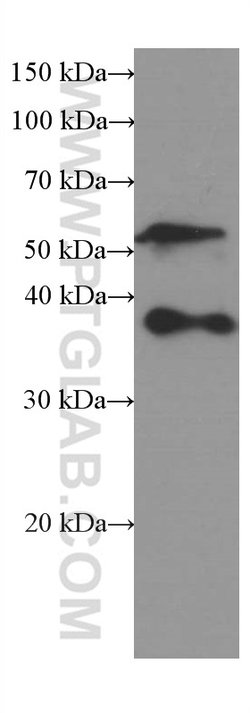 SPARC Mouse anti-Human, Clone: 1A2C1, Proteintech:Antibodies:Primary Antibodies