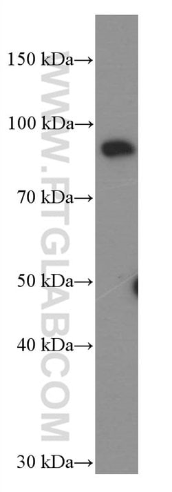 STAT5B Mouse anti-Human, Clone: 1D9B11, Proteintech:Antibodies:Primary