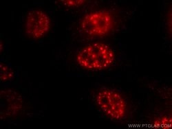 FOXO3A Mouse anti-Human, Mouse, Clone: 1F12D11, Proteintech:Antibodies:Primary