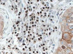 FOXO3A Mouse anti-Human, Mouse, Clone: 1F12D11, Proteintech:Antibodies:Primary