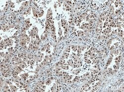 FOXO3A Mouse anti-Human, Mouse, Clone: 1F12D11, Proteintech:Antibodies:Primary
