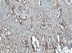 FOXO3A Mouse anti-Human, Mouse, Clone: 1F12D11, Proteintech:Antibodies:Primary
