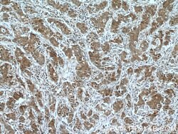 FOXO3A Mouse anti-Human, Mouse, Clone: 1F12D11, Proteintech:Antibodies:Primary