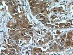 FOXO3A Mouse anti-Human, Mouse, Clone: 1F12D11, Proteintech:Antibodies:Primary