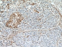 Amphiregulin Mouse anti-Human, Rat, Clone: 1A1G9, Proteintech 150 &mu;L;