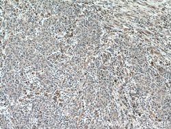Amphiregulin Mouse anti-Human, Rat, Clone: 1A1G9, Proteintech 150 &mu;L;