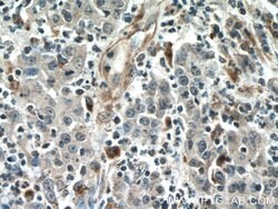 Amphiregulin Mouse anti-Human, Rat, Clone: 1A1G9, Proteintech 150 &mu;L;