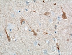 KChIP1 Mouse anti-Human, Clone: 3D6C1, Proteintech 20 &mu;L | Buy Online | Proteintech | Fisher Scientific