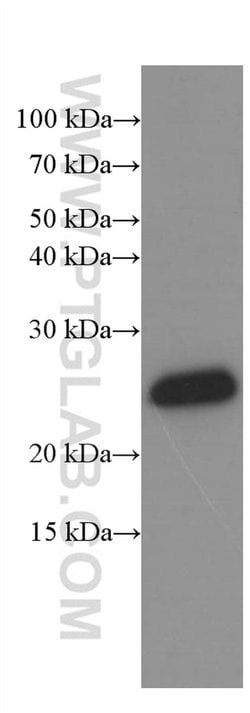 KChIP1 Mouse anti-Human, Clone: 3D6C1, Proteintech 20 &mu;L | Buy Online | Proteintech | Fisher Scientific