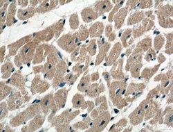 KChIP1 Mouse anti-Human, Clone: 3D6C1, Proteintech 20 &mu;L | Buy Online | Proteintech | Fisher Scientific