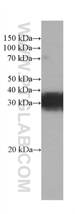 RGS4 Mouse anti-Human, Mouse, Porcine, Rat, Clone: 1E2E2, Proteintech 20