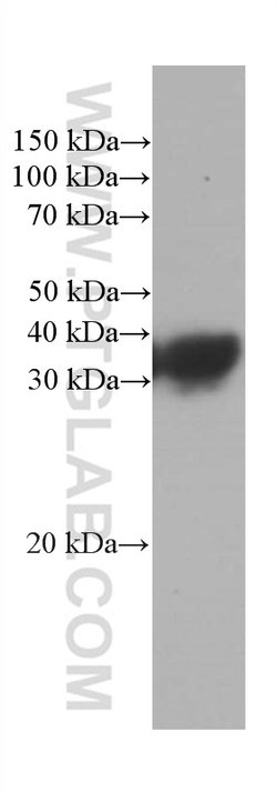 RGS4 Mouse anti-Human, Mouse, Porcine, Rat, Clone: 1E2E2, Proteintech 20