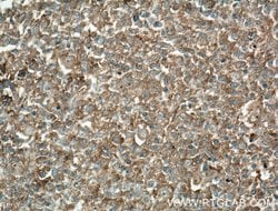 HVCN1 Mouse anti-Human, Clone: 1E4C4, Proteintech 150 &mu;L | Buy Online | Proteintech Group Inc | Fisher Scientific