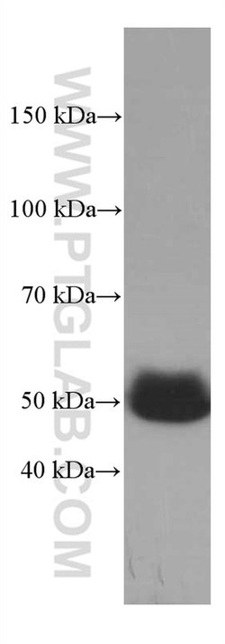 SERPINA7 Mouse anti-Human, Mouse, Clone: 1B11B10, Proteintech 150 &mu;L;